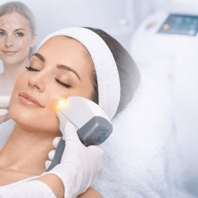 Tratamiento IPL para rejuvenecimiento facial